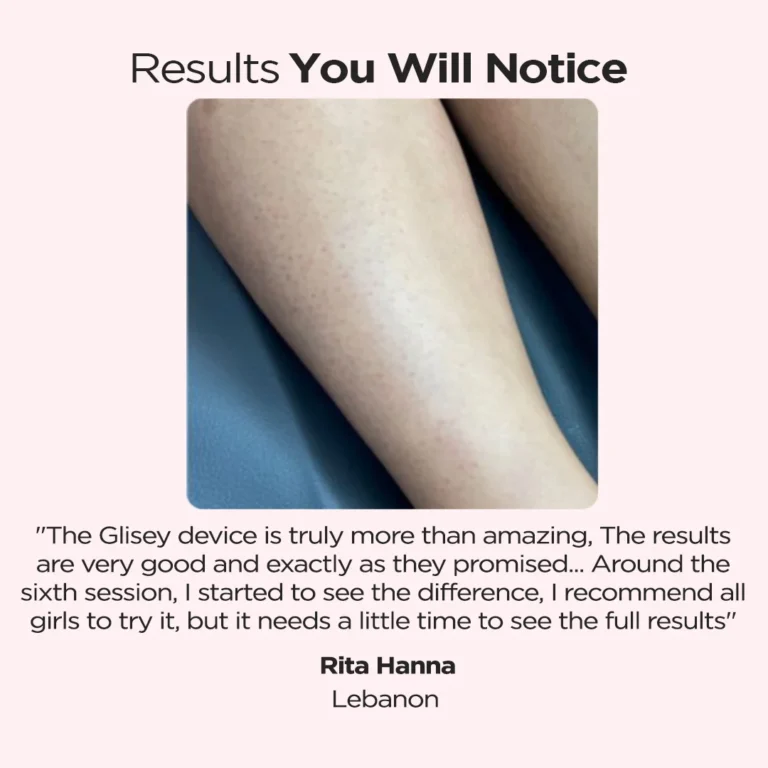 hair removal review EN after meta compliance webp